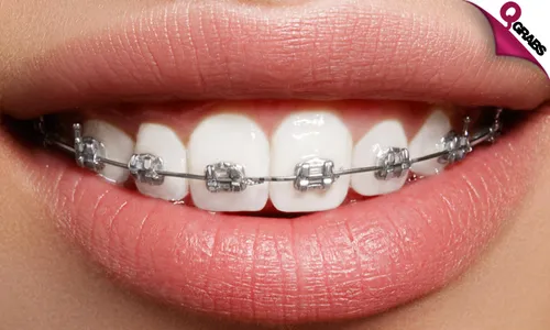 Orthodontic Treatment!